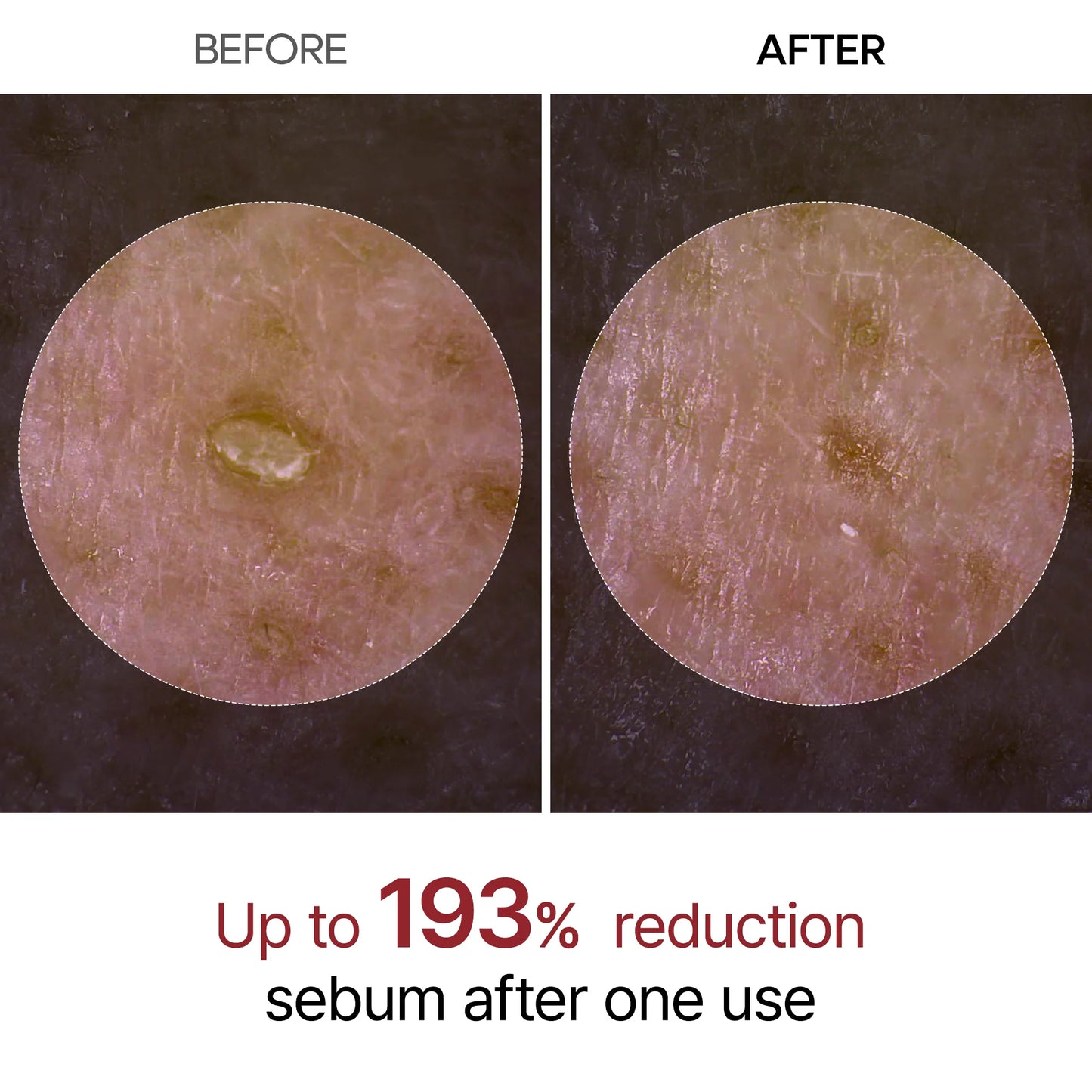 Peel Shot Glow Serum Bundle