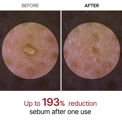 Peel Shot Glow Serum Bundle